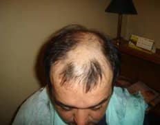 Slider image (7) Vita Hair | Clinica Capilar